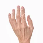 Tutore per dito a scatto Oval 8 Tielle Camp indossato di lato