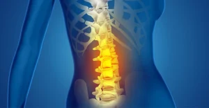 Affrontare il Dolore Lombare Rimedi Pratici