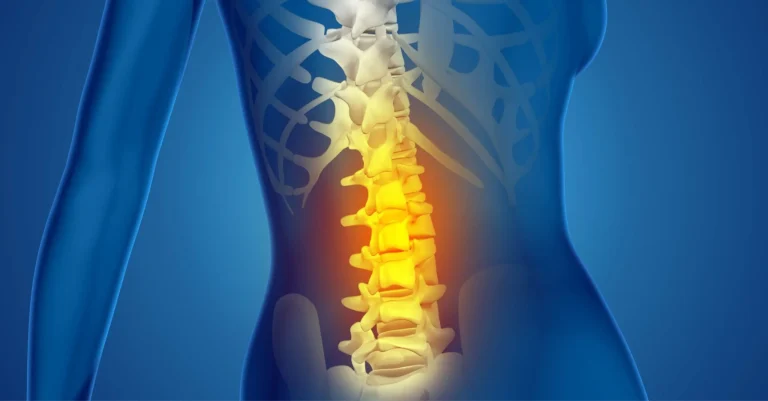 Affrontare il Dolore Lombare: Rimedi Pratici